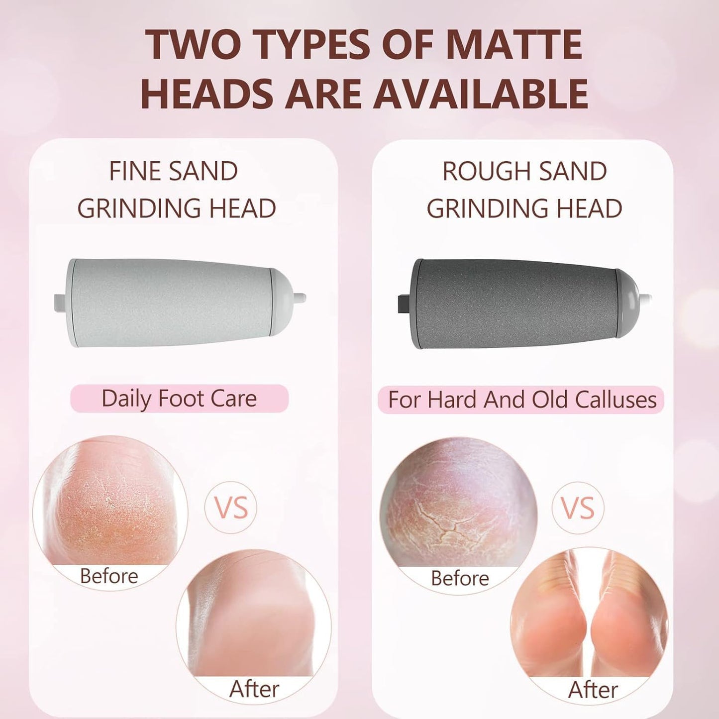 𝐄𝐥𝐞𝐜𝐭𝐫𝐢𝐜 𝐂𝐚𝐥𝐥𝐮𝐬 𝐑𝐞𝐦𝐨𝐯𝐞𝐫𝐬 𝐟𝐨𝐫 𝐅𝐞𝐞𝐭